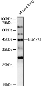 NUCKS1 Rabbit polyclonal antibody