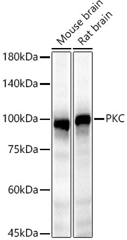 PKC epsilon Rabbit polyclonal antibody