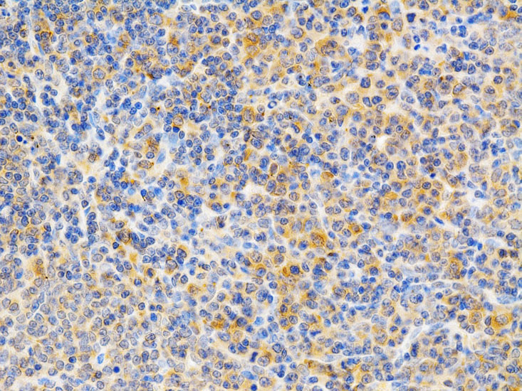 PKC epsilon Rabbit polyclonal antibody