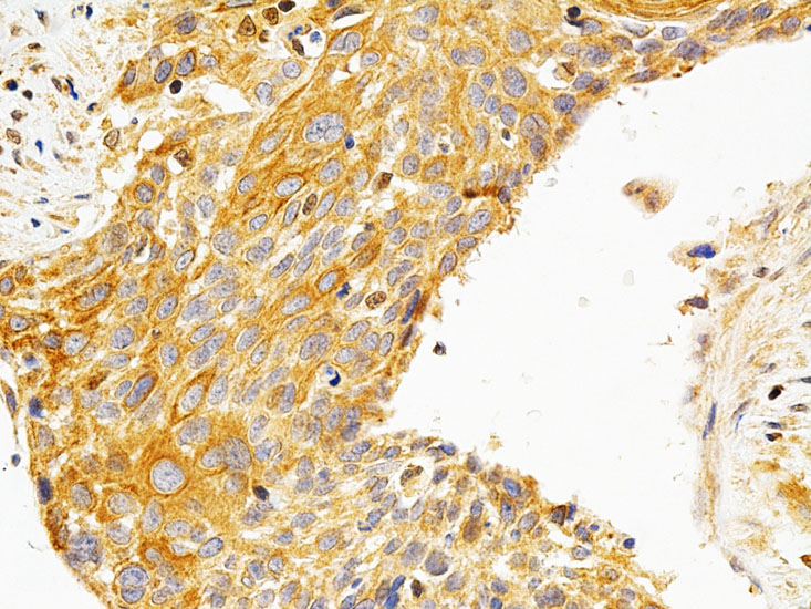 PKC epsilon Rabbit polyclonal antibody