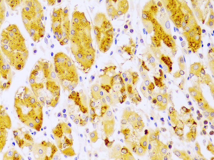 PKC epsilon Rabbit polyclonal antibody