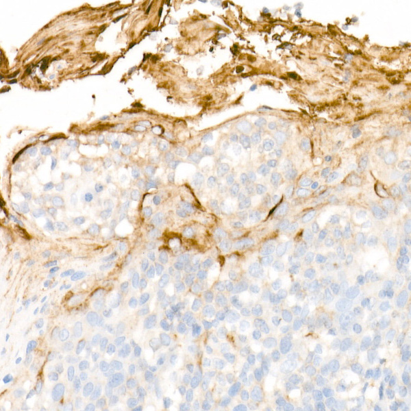 Clusterin Rabbit monoclonal antibody