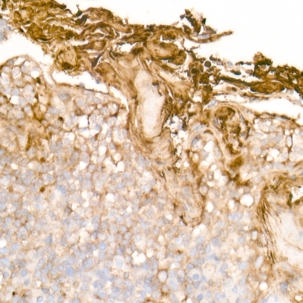 Clusterin Rabbit monoclonal antibody