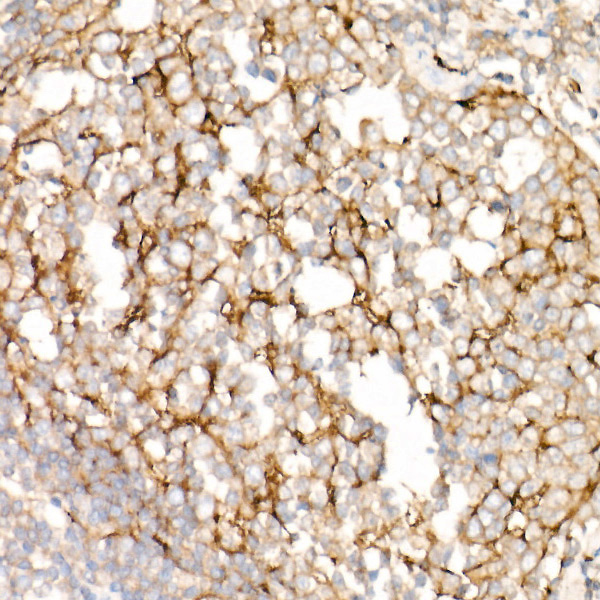 Clusterin Rabbit monoclonal antibody
