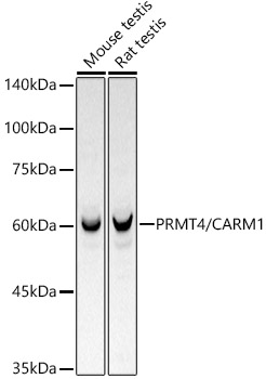 [KO Validated] PRMT4/CARM1 Rabbit monoclonal antibody