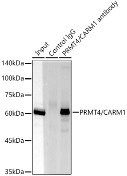 [KO Validated] PRMT4/CARM1 Rabbit monoclonal antibody