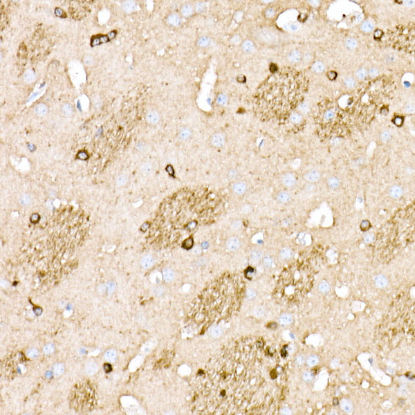 BIN1 Rabbit monoclonal antibody