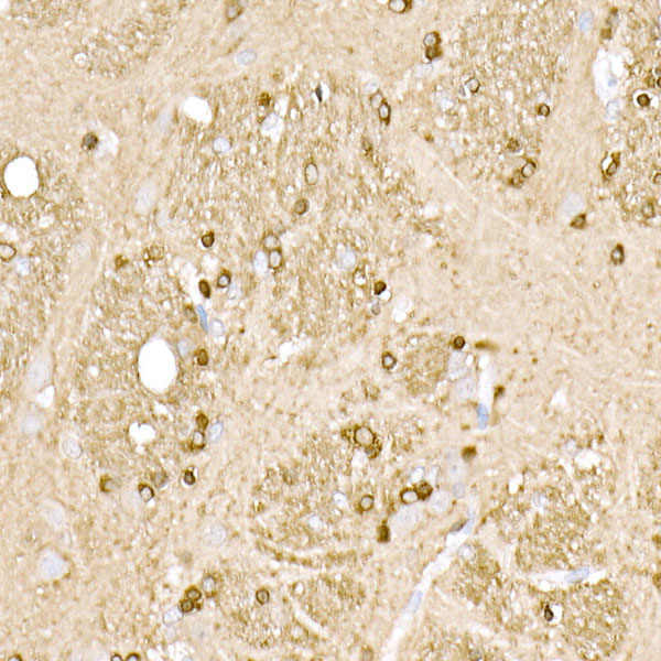 BIN1 Rabbit monoclonal antibody