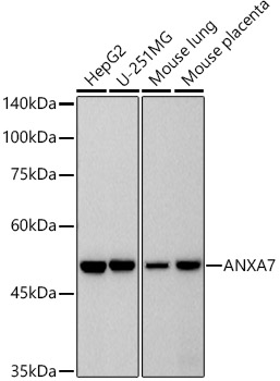 ANXA7 Rabbit monoclonal antibody