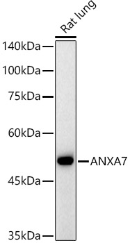 ANXA7 Rabbit monoclonal antibody