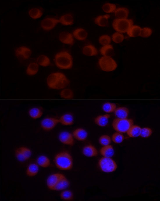 ANXA7 Rabbit monoclonal antibody