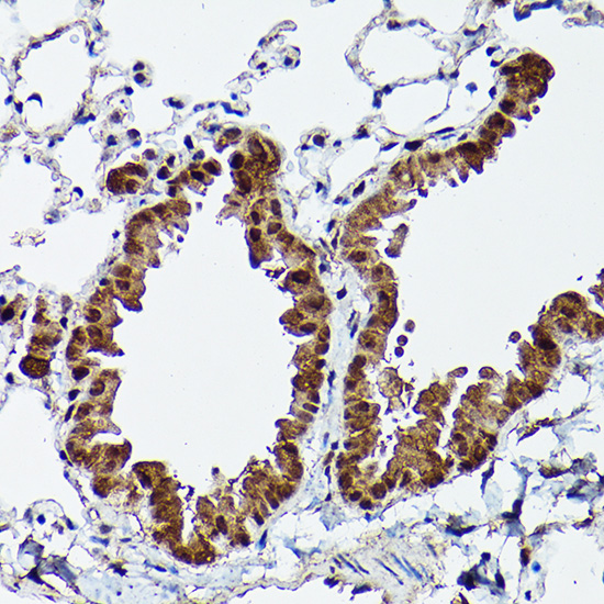 ERK5 Rabbit polyclonal antibody