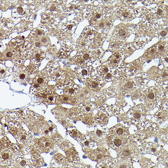 ERK5 Rabbit polyclonal antibody