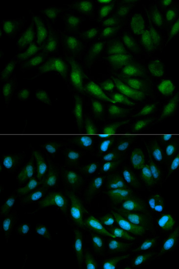 ERK5 Rabbit polyclonal antibody