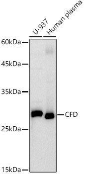 Western blot analysis of various lysates using CFD Rabbit mAb (A21110) at1:1000 dilution.<br/>Secondary antibody: HRP Goat Anti-Rabbit IgG (H+L) (AS014) at 1:10000 dilution.<br/>Lysates/proteins: 25μg per lane.<br/>Blocking buffer: 3% nonfat dry milk in TBST.<br/>Detection: ECL Basic Kit (RM00020).<br/>Exposure time: 90s.