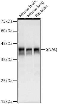 GNAQ Rabbit monoclonal antibody