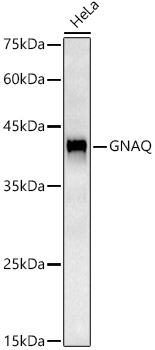 GNAQ Rabbit monoclonal antibody