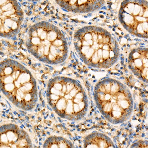 GNAQ Rabbit monoclonal antibody