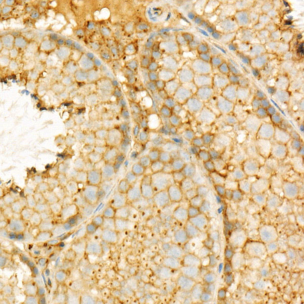 GNAQ Rabbit monoclonal antibody