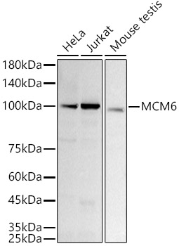 [KD Validated] MCM6 Rabbit monoclonal antibody