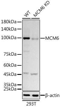 [KD Validated] MCM6 Rabbit monoclonal antibody