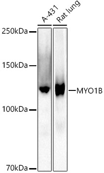 MYO1B Rabbit monoclonal antibody