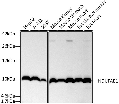 NDUFAB1 Rabbit monoclonal antibody