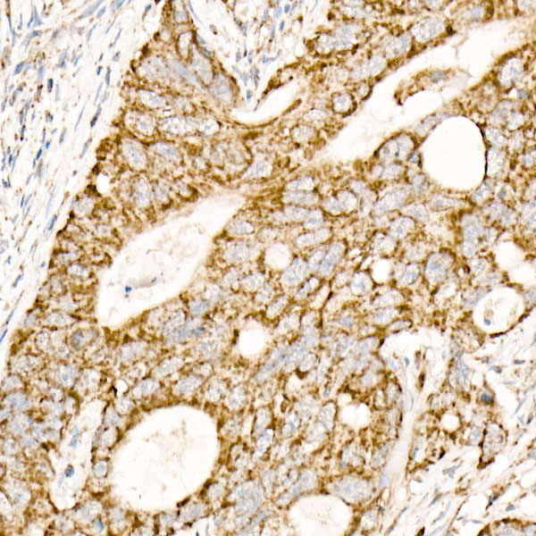 NDUFAB1 Rabbit monoclonal antibody