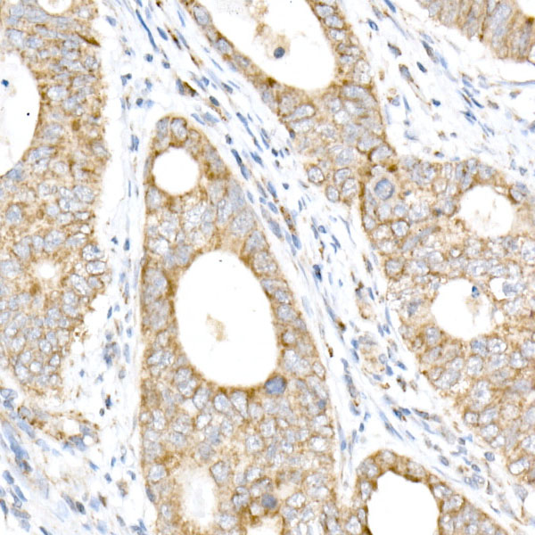 NDUFB4 Rabbit monoclonal antibody