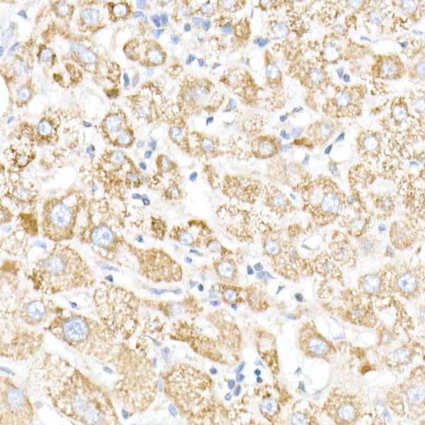 NDUFB4 Rabbit monoclonal antibody