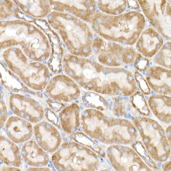 NDUFB4 Rabbit monoclonal antibody