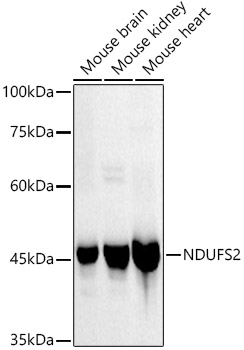 NDUFS2 Rabbit monoclonal antibody