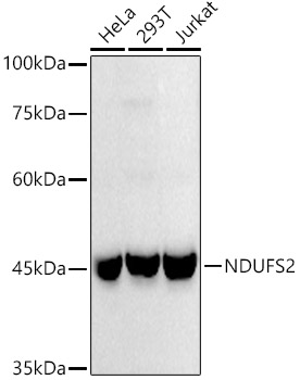 NDUFS2 Rabbit monoclonal antibody