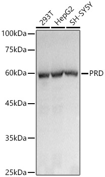 Western blot analysis of various lysates using PRD Rabbit mAb (A21120) at1:1000 dilution.<br/>Secondary antibody: HRP Goat Anti-Rabbit IgG (H+L) (AS014) at 1:10000 dilution.<br/>Lysates/proteins: 25μg per lane.<br/>Blocking buffer: 3% nonfat dry milk in TBST.<br/>Detection: ECL Basic Kit (RM00020).<br/>Exposure time: 1s.