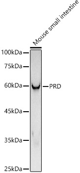 PRD Rabbit monoclonal antibody