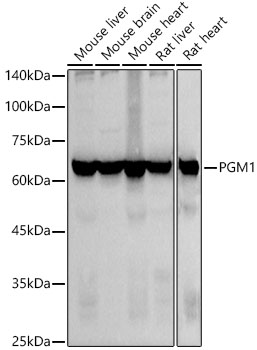 PGM1 Rabbit monoclonal antibody