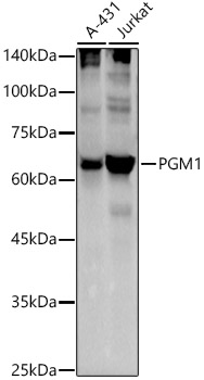 PGM1 Rabbit monoclonal antibody