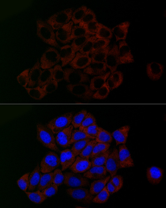 PGM1 Rabbit monoclonal antibody