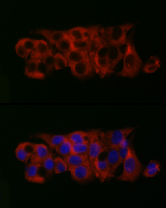 PGM1 Rabbit monoclonal antibody