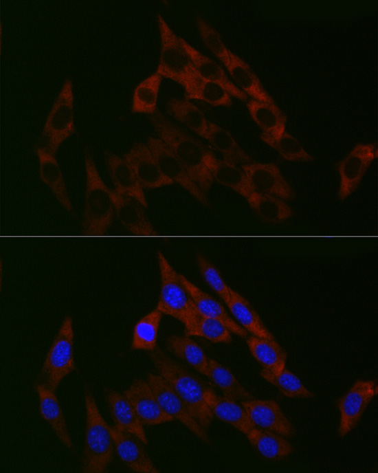 PGM1 Rabbit monoclonal antibody