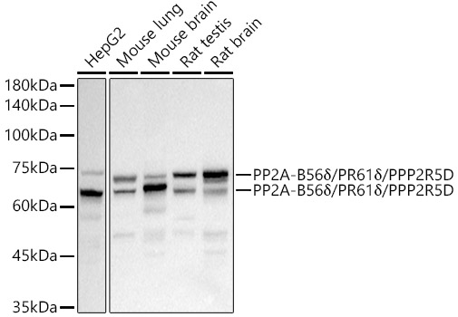 PP2A-B56D Delta/PR61D Delta/PPP2R5D Rabbit monoclonal antibody