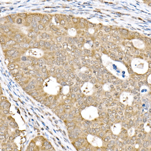PP2A-B56D Delta/PR61D Delta/PPP2R5D Rabbit monoclonal antibody