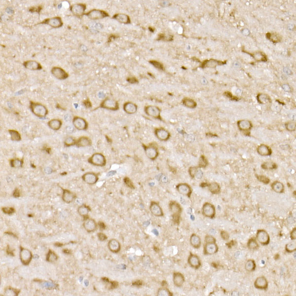 PP2A-B56D Delta/PR61D Delta/PPP2R5D Rabbit monoclonal antibody