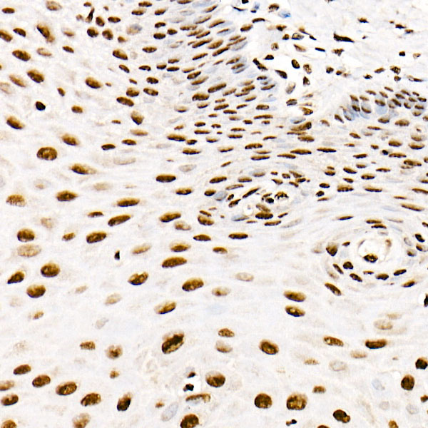 SAFB Rabbit monoclonal antibody