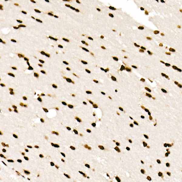 SAFB Rabbit monoclonal antibody