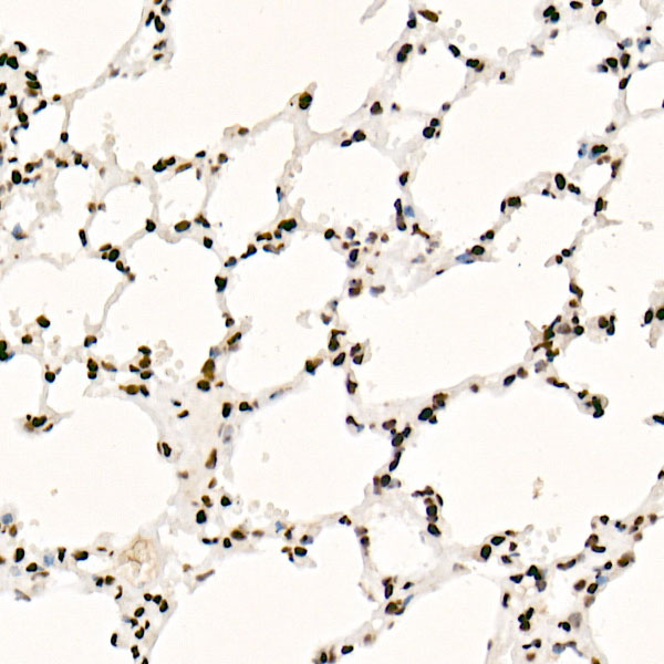 SAFB Rabbit monoclonal antibody