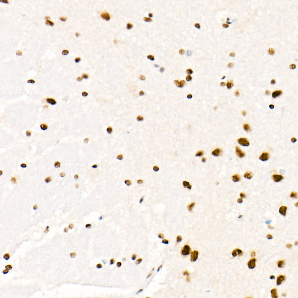 SAFB Rabbit monoclonal antibody