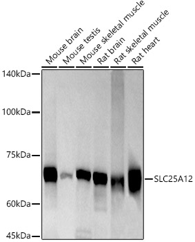 SLC25A12 Rabbit monoclonal antibody