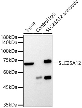 SLC25A12 Rabbit monoclonal antibody