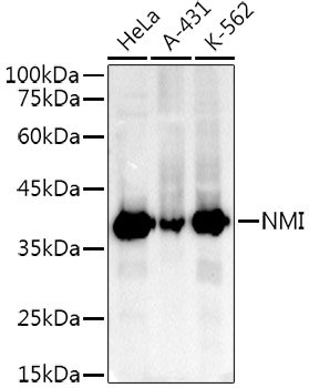 NMI Rabbit monoclonal antibody